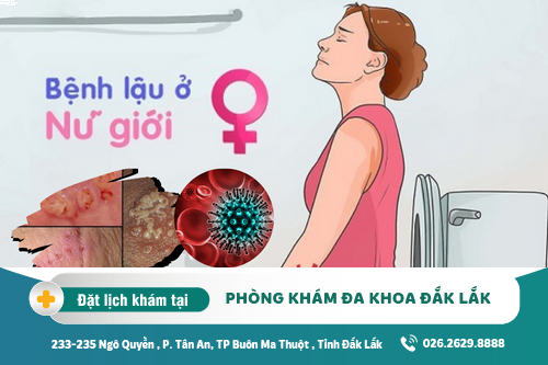 Cách chữa bệnh lậu Đắk Lắk - Bệnh lậu ở nữ có triệu chứng gì?