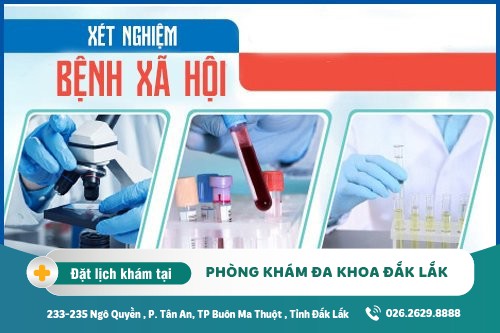 Chữa bệnh xã hội Đắk Lắk - Xét nghiệm bệnh xã hội gồm những phương pháp nào?