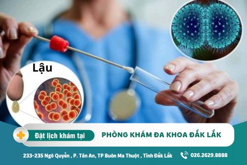 Xét nghiệm bệnh xã hội Đắk Lắk - Xét nghiệm bệnh lậu uy tín ở đâu?